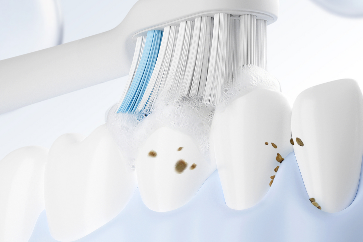 10X Plaque Removal Efficiency (vs. Manual Toothbrush)